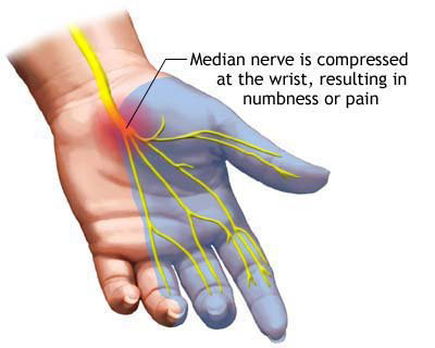 Spine Cord Surgery