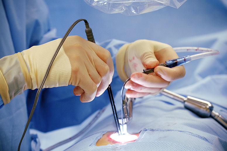 Micro Endoscopic Surgery
