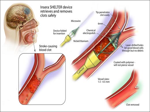 PAIN TREATMENT